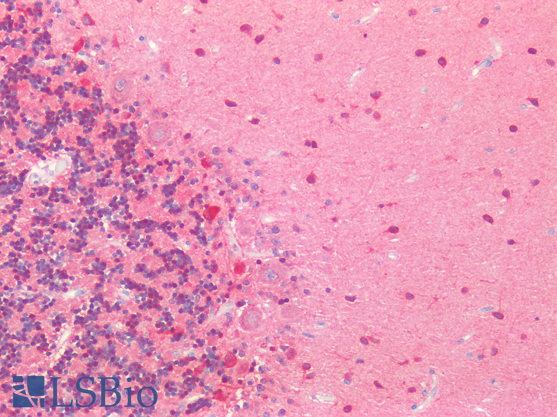 MAPT / Tau Antibody - Human Brain, Cerebellum: Formalin-Fixed, Paraffin-Embedded (FFPE)