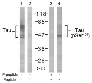 MAPT / Tau Antibody - Western blot of extract from mouse brain tissue using Rabbit Anti-Tau (Ab-404) Polyclonal Antibody (lane 1 and 2) and Rabbit Anti-Tau (Phospho-Ser404) Polyclonal Antibody