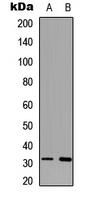 MARCH1 Antibody - Western blot analysis of 42064 expression in K562 (A); mouse brain (B) whole cell lysates.