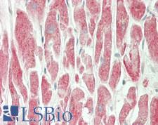 MARCH1 Antibody - Human Heart: Formalin-Fixed, Paraffin-Embedded (FFPE)
