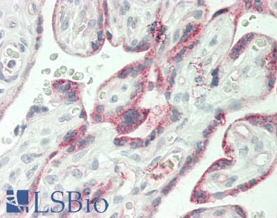 MARCH1 Antibody - Human Placenta: Formalin-Fixed, Paraffin-Embedded (FFPE)