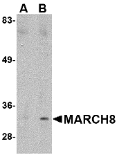 MARCH8 Antibody - Western blot of MARCH8 in HeLa cell lysate with MARCH8 antibody at (A) 0.5 ug/ml and (B) 1 ug/ml.