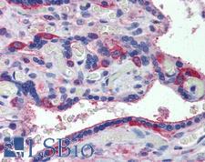 MARCH8 Antibody - Anti-MARCH8 antibody IHC of human placenta. Immunohistochemistry of formalin-fixed, paraffin-embedded tissue after heat-induced antigen retrieval. Antibody concentration 5 ug/ml.