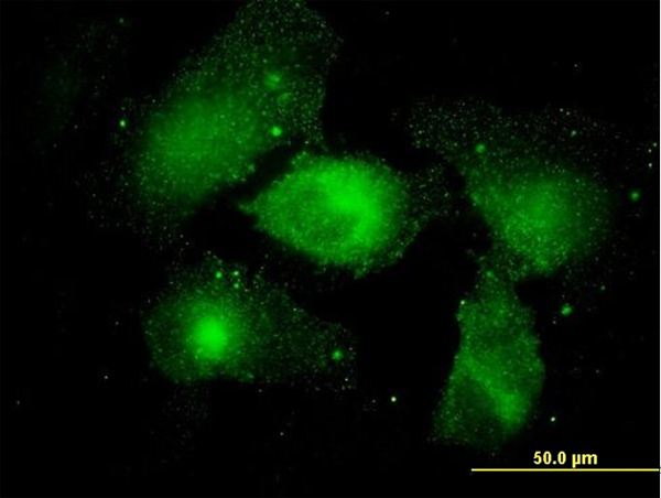 MARCKS Antibody - Immunofluorescence of monoclonal antibody to MARCKS on HeLa cell. [antibody concentration 10 ug/ml]