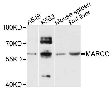 MARCO Antibody - Western blot analysis of extracts of various cell lines, using MARCO antibody at 1:1000 dilution. The secondary antibody used was an HRP Goat Anti-Rabbit IgG (H+L) at 1:10000 dilution. Lysates were loaded 25ug per lane and 3% nonfat dry milk in TBST was used for blocking. An ECL Kit was used for detection and the exposure time was 30s.