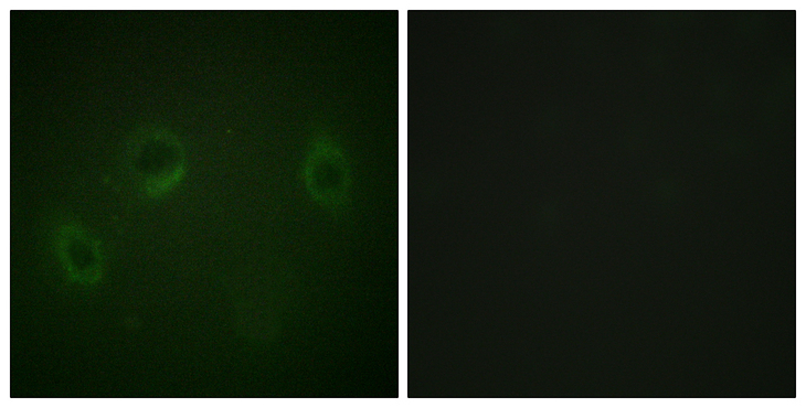 MARK1+2+3+4 Antibody - Immunofluorescence analysis of HeLa cells, using MARK1/2/3/4 Antibody. The picture on the right is blocked with the synthesized peptide.