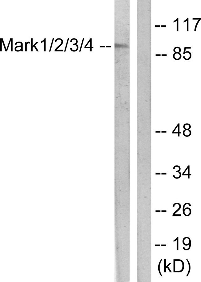 MARK1+2+3+4 Antibody - Western blot analysis of lysates from COS7 cells, using MARK1/2/3/4 Antibody. The lane on the right is blocked with the synthesized peptide.