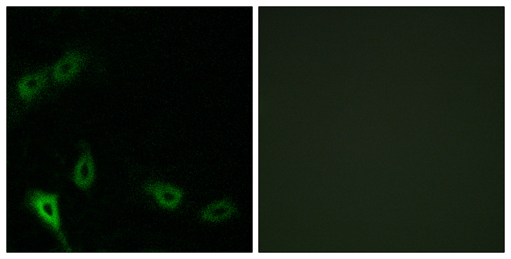 MARK2 Antibody - Immunofluorescence analysis of A549 cells, using MARK2 Antibody. The picture on the right is blocked with the synthesized peptide.