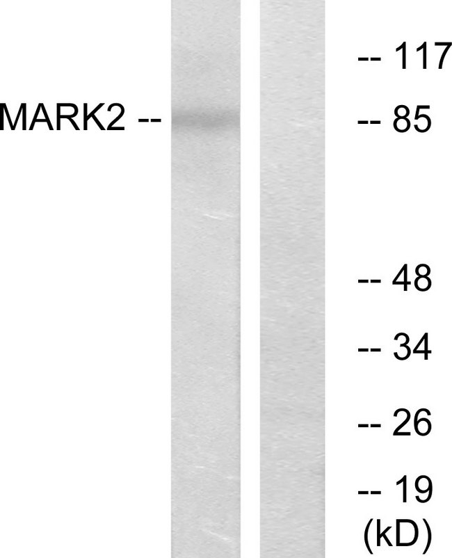 MARK2 Antibody - Western blot analysis of lysates from COS7 cells, using MARK2 Antibody. The lane on the right is blocked with the synthesized peptide.