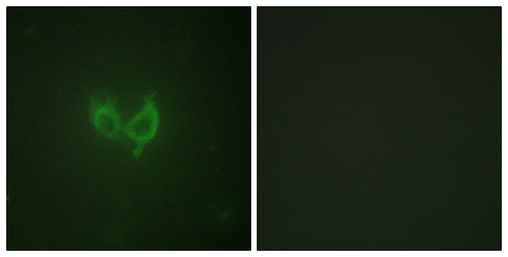 MARK2 Antibody - Immunofluorescence analysis of HUVEC cells, using MARK2 Antibody. The picture on the right is blocked with the synthesized peptide.