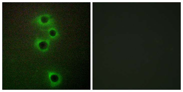 MARK4 Antibody - Immunofluorescence analysis of A549 cells, using MARK4 Antibody. The picture on the right is blocked with the synthesized peptide.