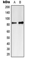 MARK4 Antibody - Western blot analysis of MARK4 expression in Jurkat (A); K562 (B) whole cell lysates.