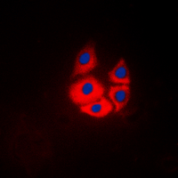 MARK4 Antibody - Immunofluorescent analysis of MARK4 staining in Jurkat cells. Formalin-fixed cells were permeabilized with 0.1% Triton X-100 in TBS for 5-10 minutes and blocked with 3% BSA-PBS for 30 minutes at room temperature. Cells were probed with the primary antibody in 3% BSA-PBS and incubated overnight at 4 C in a humidified chamber. Cells were washed with PBST and incubated with a DyLight 594-conjugated secondary antibody (red) in PBS at room temperature in the dark. DAPI was used to stain the cell nuclei (blue).