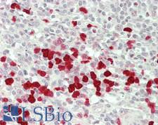 MARK4 Antibody - Human Spleen: Formalin-Fixed, Paraffin-Embedded (FFPE)