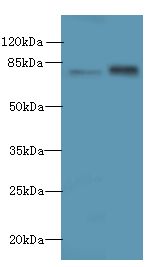 MASP1 / MASP Antibody - Western blot. All lanes: MASP1 antibody at 6 ug/ml. Lane 1: HeLa whole cell lysate. Lane 2: U251 whole cell lysate. Secondary Goat polyclonal to Rabbit IgG at 1:10000 dilution. Predicted band size: 79 kDa. Observed band size: 79 kDa.