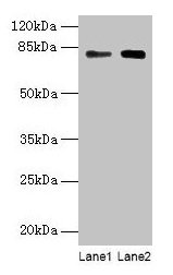 MASP1 / MASP Antibody - Western blot All lanes: MASP1 antibody at 6µg/ml Lane 1: Hela whole cell lysate Lane 2: U251 whole cell lysate Secondary Goat polyclonal to rabbit IgG at 1/10000 dilution Predicted band size: 80, 82, 44, 69 kDa Observed band size: 80 kDa