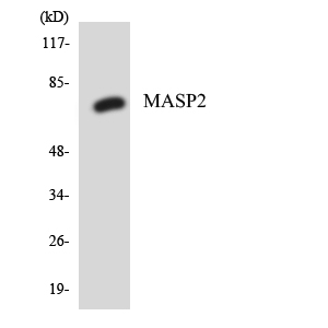 MASP2 / MASP-2 Antibody - Western blot analysis of the lysates from HT-29 cells using MASP2 antibody.