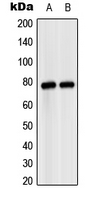 MASP2 / MASP-2 Antibody - Western blot analysis of MASP2 expression in HeLa (A); SP2/0 (B) whole cell lysates.
