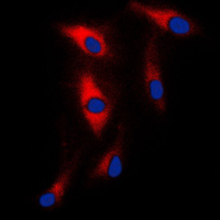 MAST205 / MAST2 Antibody - Immunofluorescent analysis of MAST2 staining in HeLa cells. Formalin-fixed cells were permeabilized with 0.1% Triton X-100 in TBS for 5-10 minutes and blocked with 3% BSA-PBS for 30 minutes at room temperature. Cells were probed with the primary antibody in 3% BSA-PBS and incubated overnight at 4 C in a humidified chamber. Cells were washed with PBST and incubated with a DyLight 594-conjugated secondary antibody (red) in PBS at room temperature in the dark. DAPI was used to stain the cell nuclei (blue).