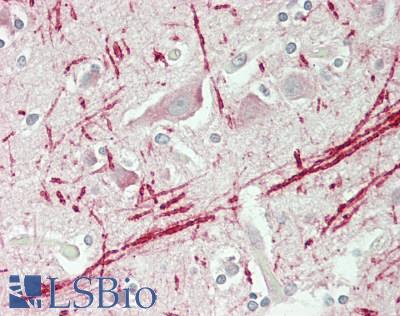 MAST205 / MAST2 Antibody - Human Brain, Cortex: Formalin-Fixed, Paraffin-Embedded (FFPE)