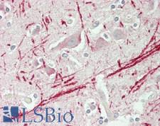 MAST205 / MAST2 Antibody - Human Brain, Cortex: Formalin-Fixed, Paraffin-Embedded (FFPE)