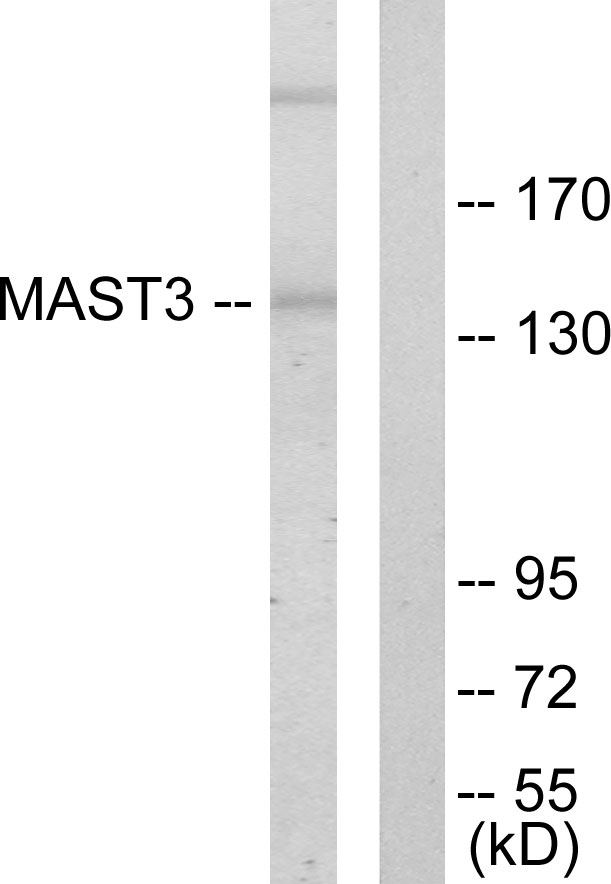 MAST3 Antibody - Western blot analysis of lysates from Jurkat cells, using MAST3 Antibody. The lane on the right is blocked with the synthesized peptide.