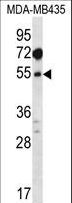 MAT / MAT1A Antibody - MAT1A Antibody western blot of MDA-MB435 cell line lysates (35 ug/lane). The MAT1A antibody detected the MAT1A protein (arrow).