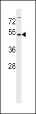MAT2A Antibody - MAT2A Antibody western blot of Ramos cell line lysates (35 ug/lane). The MAT2A antibody detected the MAT2A protein (arrow).