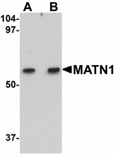 MATN1 / Matrilin 1 Antibody - Western blot of MATN1 in rat liver tissue lysate with MATN1 antibody at (A) 1 and (B) 2 ug/ml.