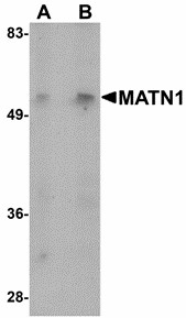 MATN1 / Matrilin 1 Antibody - Western blot of MATN1 in mouse liver tissue lysate with MATN1 antibody at (A) 1 and (B) 2 ug/ml.
