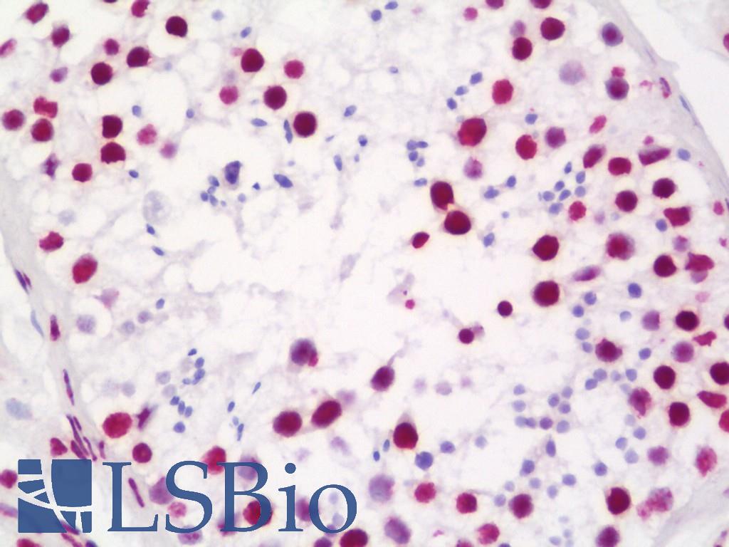 MATR3 / Matrin 3 Antibody - Anti-MATR3 / Matrin 3 antibody IHC staining of human testis. Immunohistochemistry of formalin-fixed, paraffin-embedded tissue after heat-induced antigen retrieval. Antibody dilution 1:100.