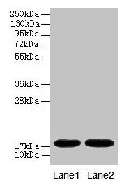 MB / Myoglobin Antibody - Western blot All lanes: Myoglobin antibody at 2µg/ml Lane 1: Rat heart tissue Lane 2: Mouse heart tissue Secondary Goat polyclonal to rabbit IgG at 1/10000 dilution Predicted band size: 17 kDa Observed band size: 17 kDa