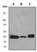 MB / Myoglobin Antibody - Western blot analysis on (A) human muscle (B) mouse muscle and (C) rat muscle tissue lysate using anti-myoglobin antibody, dilution 1:5000.