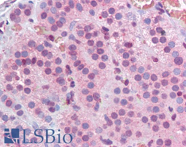 MBD2 Antibody - Anti-MBD2 antibody IHC of human adrenal. Immunohistochemistry of formalin-fixed, paraffin-embedded tissue after heat-induced antigen retrieval. Antibody concentration 2.5 ug/ml.