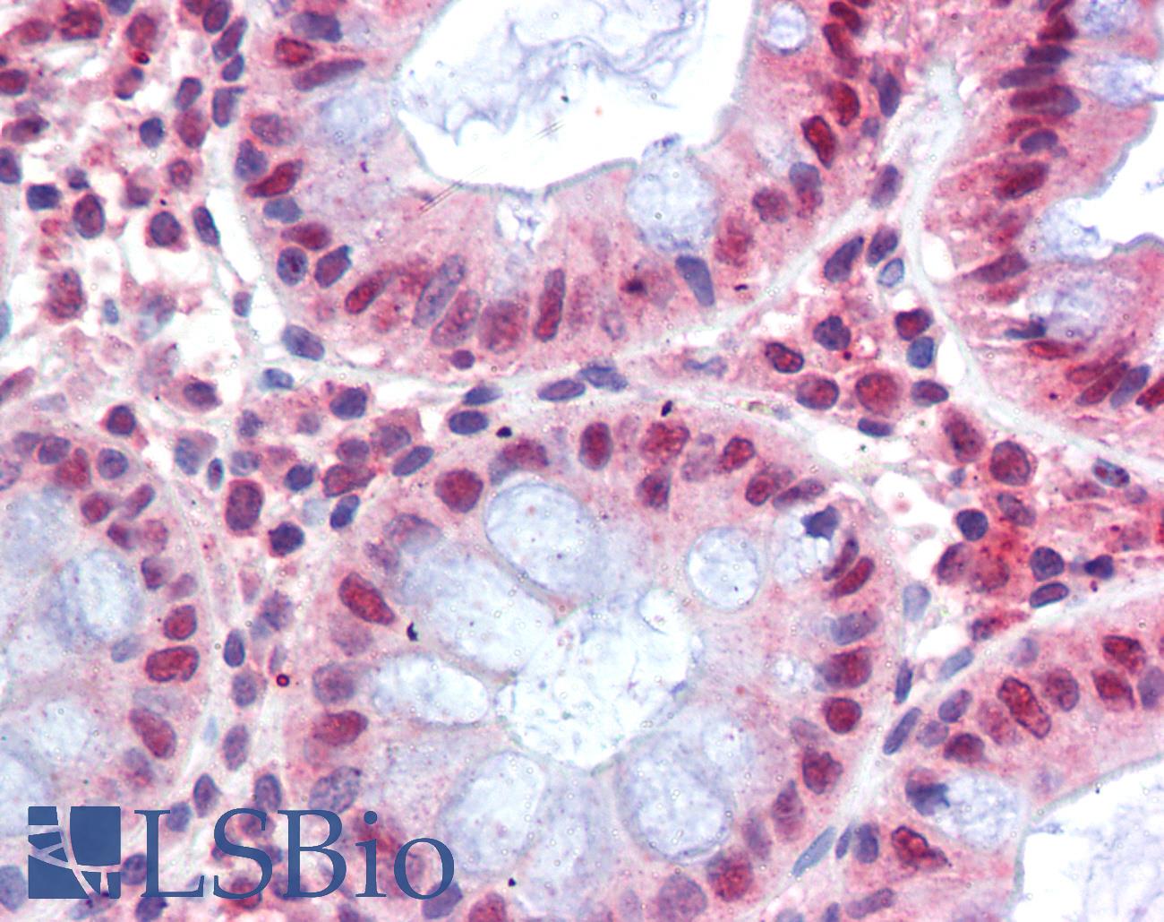 MBD2 Antibody - Anti-MBD2 antibody IHC of human colon. Immunohistochemistry of formalin-fixed, paraffin-embedded tissue after heat-induced antigen retrieval. Antibody concentration 2.5 ug/ml.