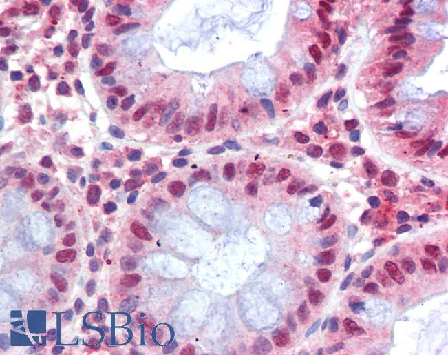 MBD2 Antibody - Anti-MBD2 antibody IHC of human colon. Immunohistochemistry of formalin-fixed, paraffin-embedded tissue after heat-induced antigen retrieval. Antibody concentration 2.5 ug/ml.