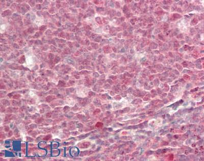 MBD3 Antibody - Human Tonsil: Formalin-Fixed, Paraffin-Embedded (FFPE)