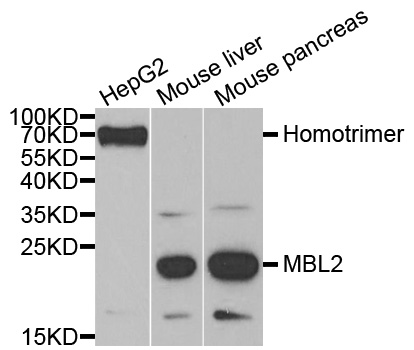 MBL2 / Mannose Binding Protein Antibody - Western blot analysis of extracts of various cell lines, using MBL2 antibody.