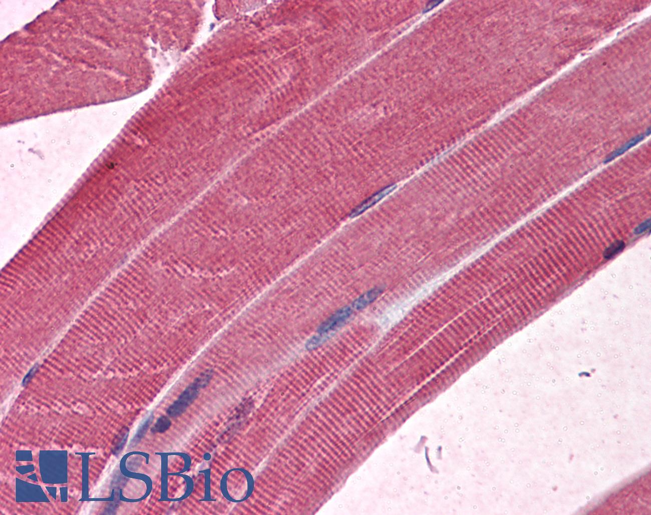 MBNL1 / MBNL Antibody - Anti-MBNL1 antibody IHC of human skeletal muscle. Immunohistochemistry of formalin-fixed, paraffin-embedded tissue after heat-induced antigen retrieval. Antibody concentration 5 ug/ml.