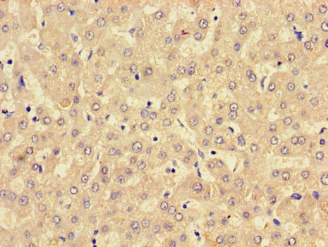 MBOAT5 / C3F Antibody - Immunohistochemistry of paraffin-embedded human liver tissue using LPCAT3 Antibody at dilution of 1:100