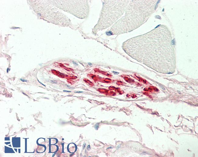 MBP Antibody - Anti-Myelin Basic Protein / MBP antibody IHC staining of human skeletal muscle, nerve. Immunohistochemistry of formalin-fixed, paraffin-embedded tissue after heat-induced antigen retrieval.