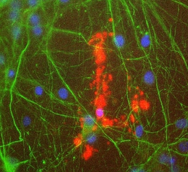MBP / Myelin Basic Protein Antibody - Rat mixed neuron/glial cultures stained with Myelin Basic Protein antibody (red), and also with chicken antibody to neurofilament NF-L CPCA-NF-L (green). Blue is a DNA stain. Note that the MBP antibody stains an oligodendrocyte and some membrane shed from this cell. Other cells in the field include neurons, astrocytes, microglia and fibroblasts, all of which are completely negative for MBP, though the neuronal processes can be seen with the NF-L antibody.