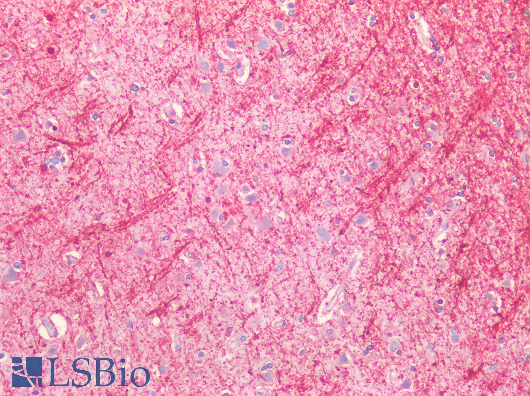 MBP / Myelin Basic Protein Antibody - Human Brain, Cortex: Formalin-Fixed, Paraffin-Embedded (FFPE)
