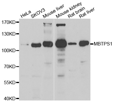 MBTPS1 / S1P Antibody - Western blot analysis of extracts of various cell lines, using MBTPS1 antibody.