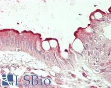 MBTPS1 / S1P Antibody - Human Colon: Formalin-Fixed, Paraffin-Embedded (FFPE)