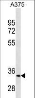 MC1R Antibody - MC1R Antibody western blot of A375 cell line lysates (35 ug/lane). The MC1R antibody detected the MC1R protein (arrow).