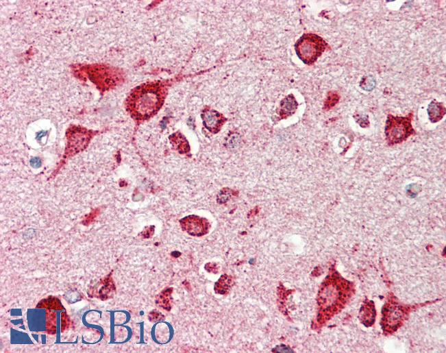 MC3R / MC3 Receptor Antibody - Anti-MC3R / MC3 Receptor antibody IHC staining of human brain, cortex. Immunohistochemistry of formalin-fixed, paraffin-embedded tissue after heat-induced antigen retrieval. Antibody dilution 1:100.