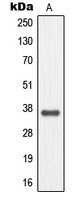 MC4R / Melanocortin 4 Receptor Antibody - Western blot analysis of MC4 Receptor expression in EOC20 (A) whole cell lysates.