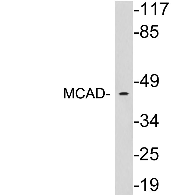 MCAD / ACADM Antibody - Western blot analysis of lysates from HeLa cells, using MCAD antibody.