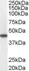 MCAD / ACADM Antibody - Antibody staining (0.05 ug/ml) of Human Heart lysate (RIPA buffer, 35 ug total protein per lane). Primary incubated for 1 hour. Detected by Western blot of chemiluminescence.